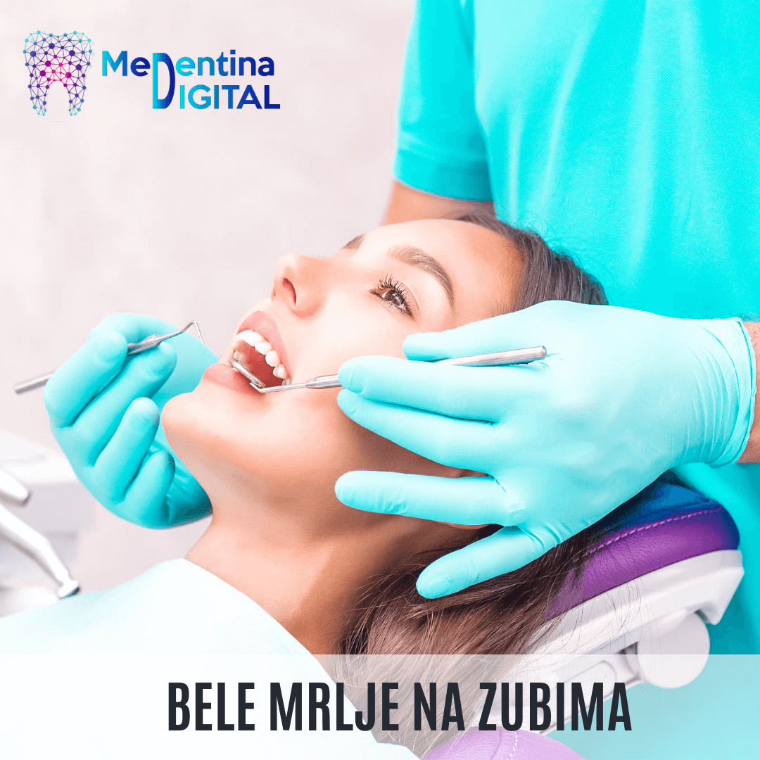 Bele mrlje na zubima
