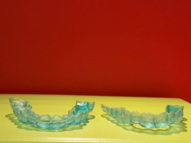 Okluzalni splint