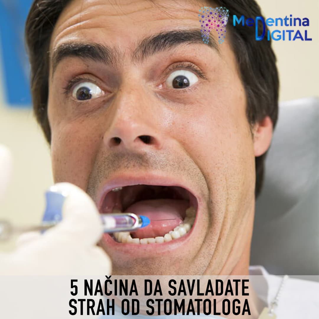 5 načina kako savladati strah od stomatologa
