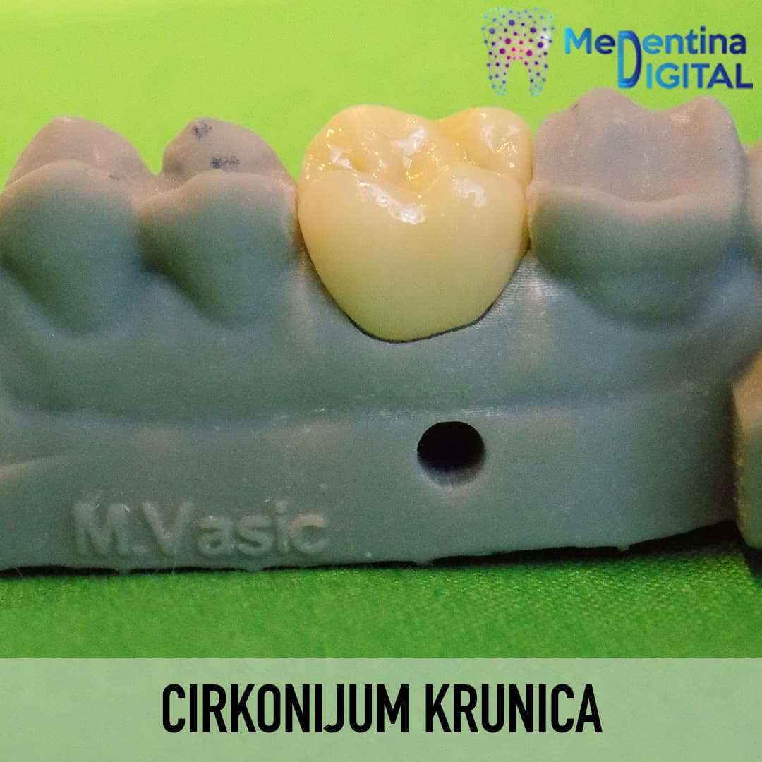 Cirkonijum krunica