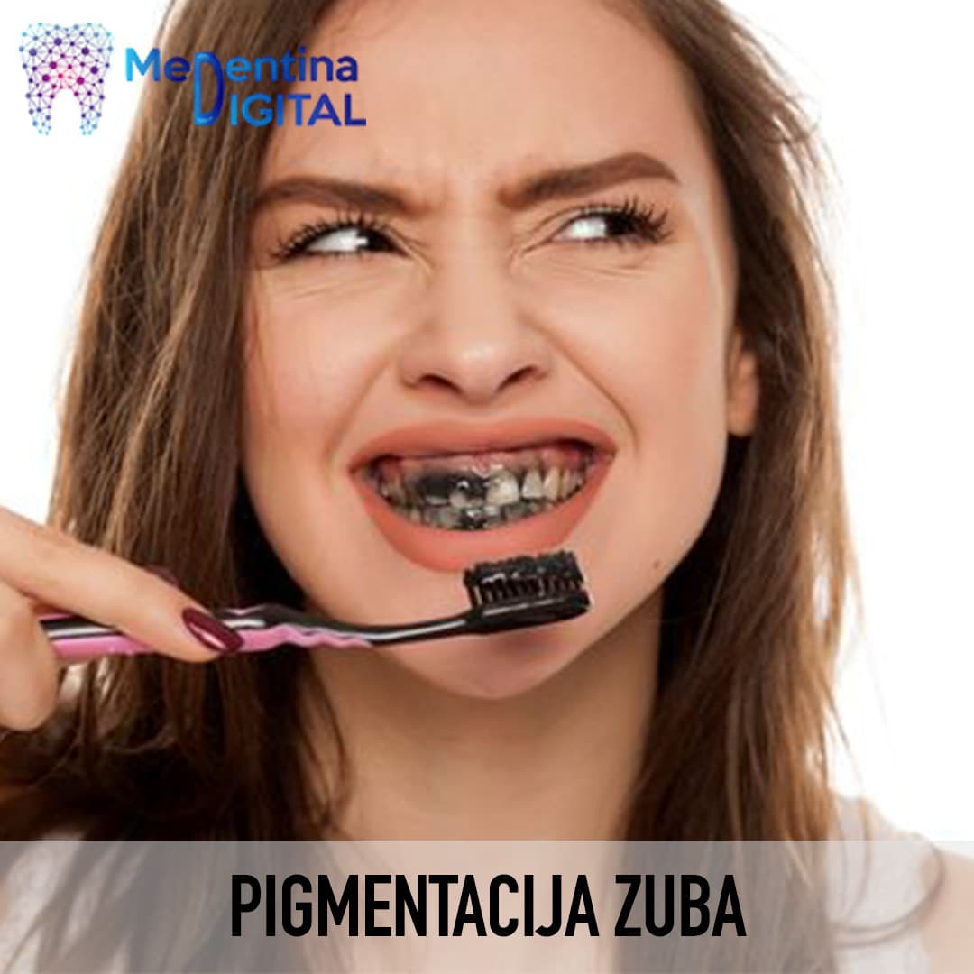 Pigmentacija zuba